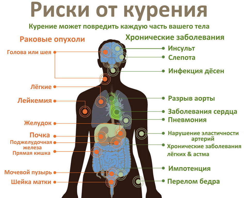 Риски от курения